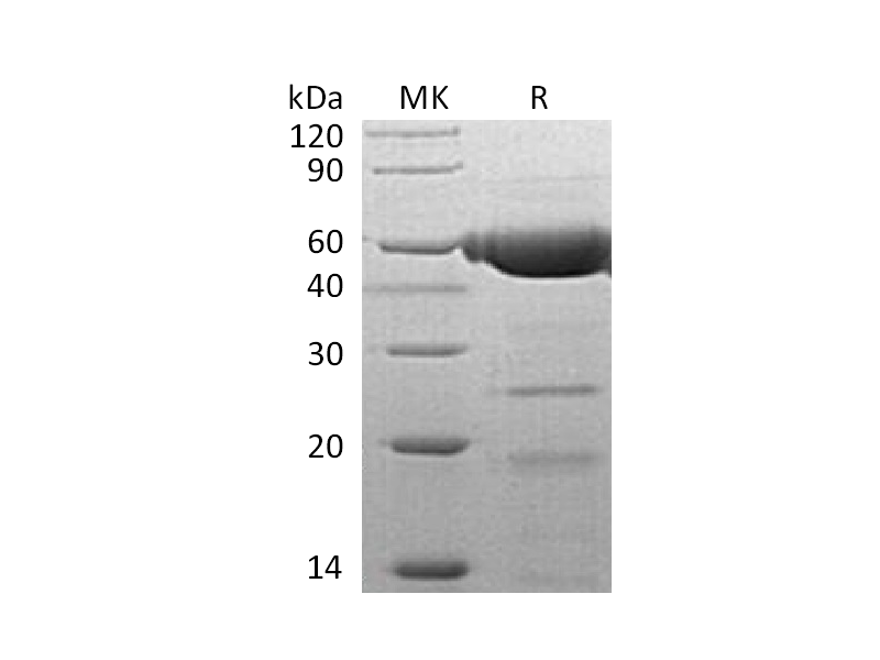 Recombinant Human PLRP2 (C-6His)