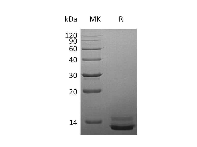 Recombinant Human PPY (C-6His)