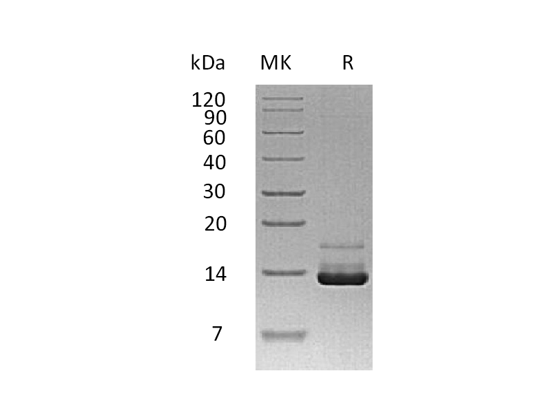 Recombinant Human PTH (N-8His)