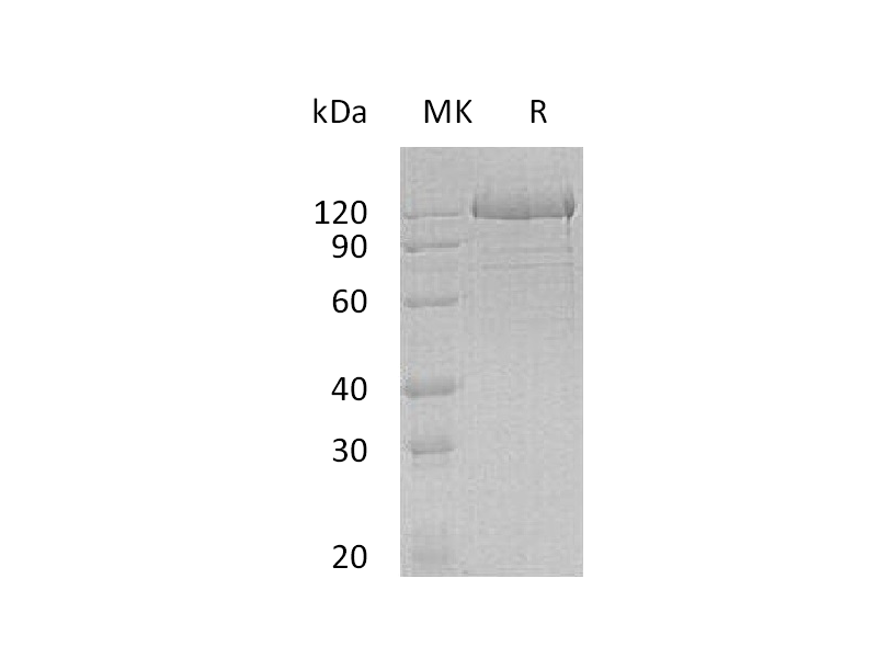Recombinant Human PCDH1 (C-6His)