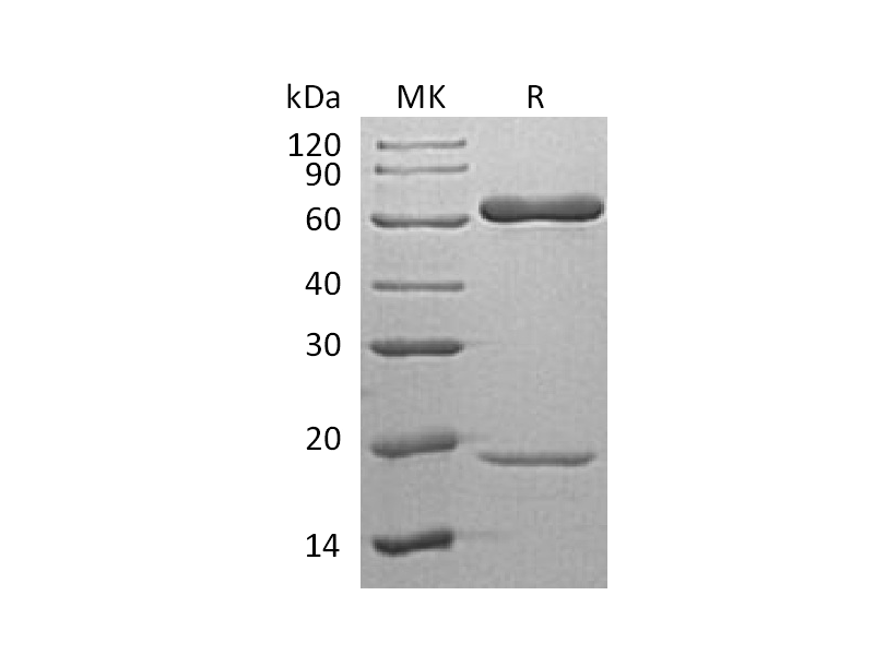 Recombinant Human PCSK9 (C-6His)