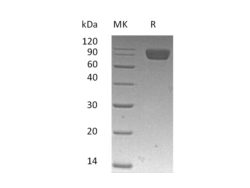 Recombinant Human PDGFRA (C-6His)