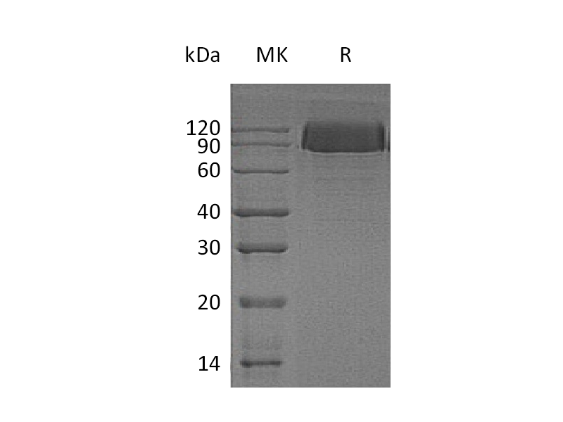 Recombinant Human PDGFRB (C-6His)