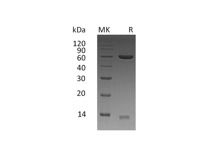 Recombinant Human PDIA3 (C-6His)