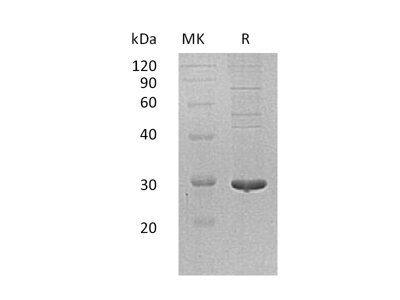 Recombinant Human PDIA5 (C-6His)