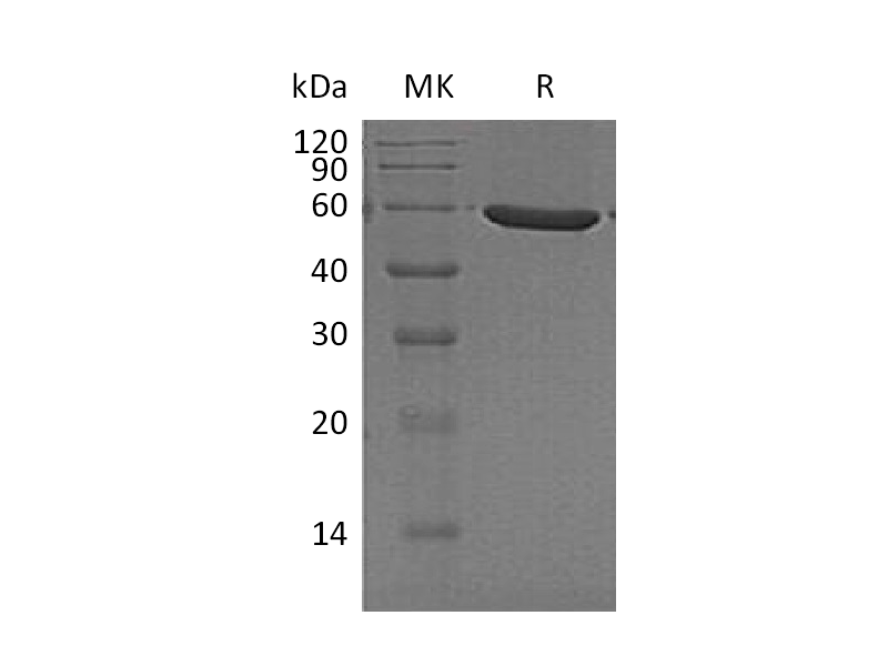 Recombinant Human PFKFB1 (C-6His)