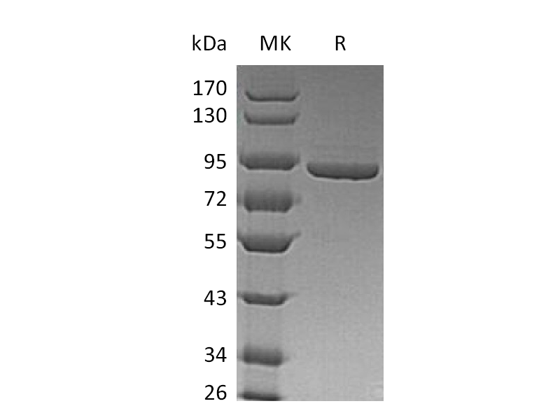 Recombinant Human PFKM (C-6His)