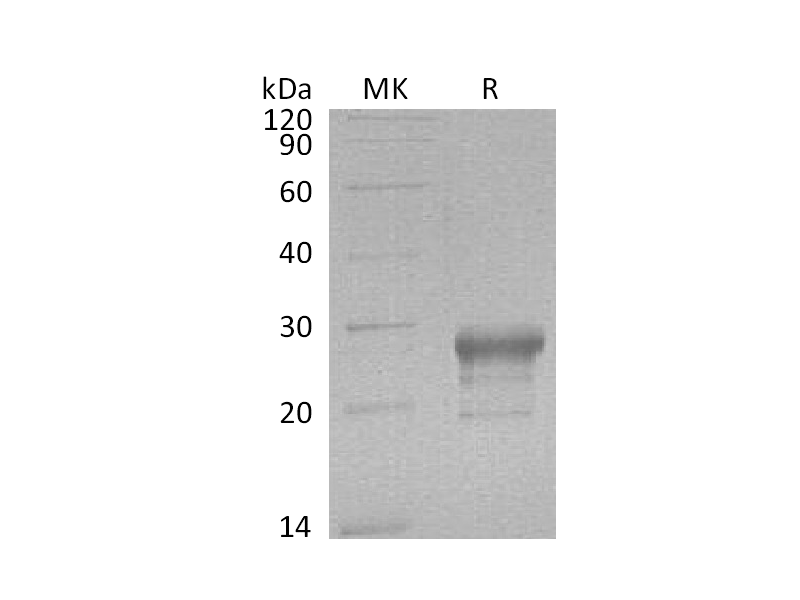 Recombinant Human PTGDS (C-6His)