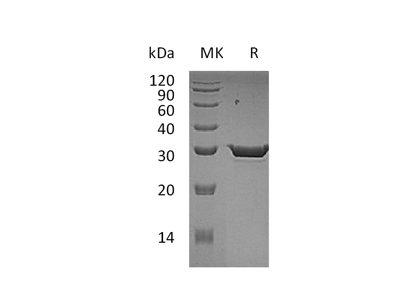 Recombinant Human HPGD (C-6His)
