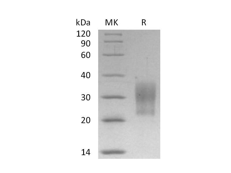 Recombinant Human PIK3IP1 (C-6His)