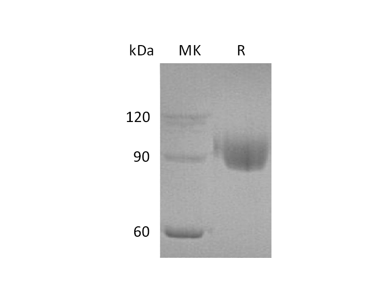 Recombinant Human PIgR (C-6His)