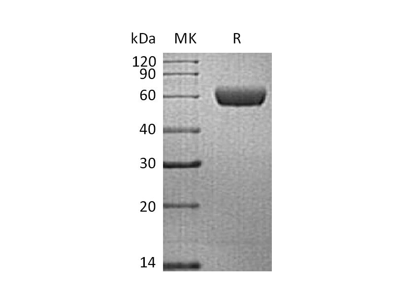 Recombinant Human PDPN (C-Fc)