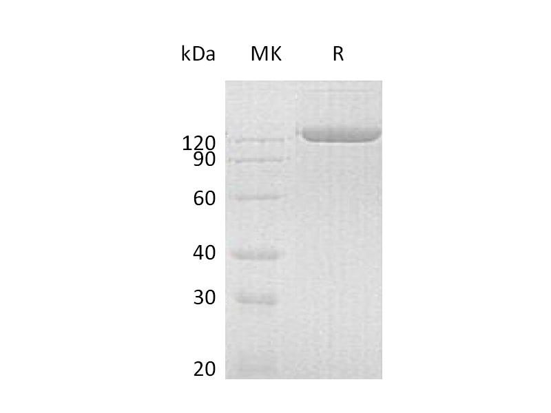 Recombinant Human pIgR (C-Fc)