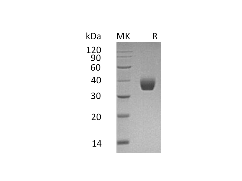 Recombinant Human PPT1 (C-6His)