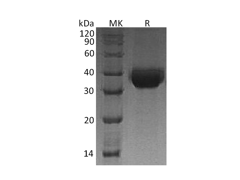 Recombinant Human DLK-1 (C-6His)
