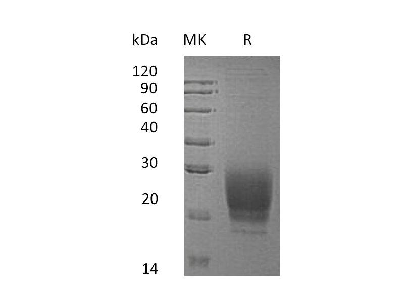 Recombinant Human PRND (C-6His)