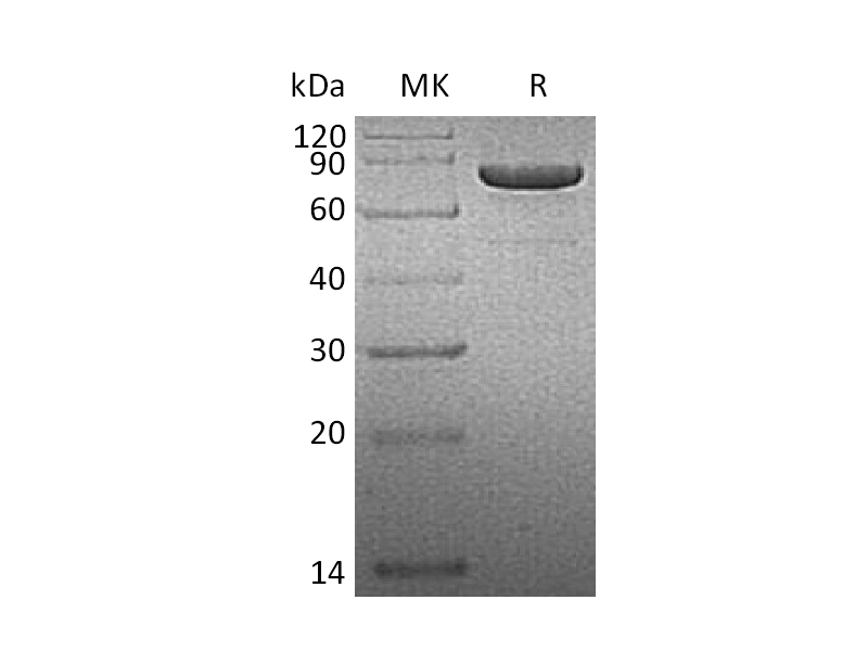 Recombinant Human PRKG1 (C-6His)