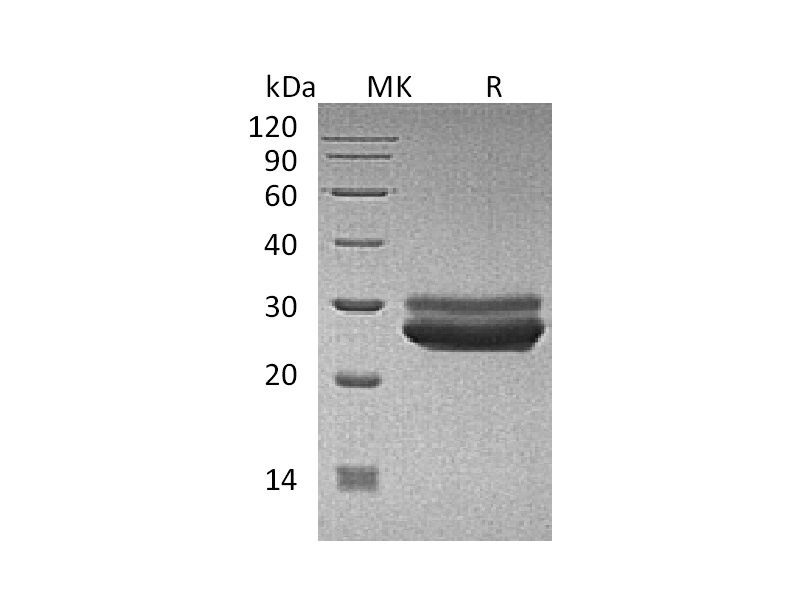 Recombinant Human PRL (C-6His)