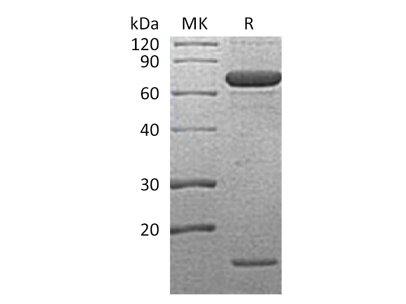 Recombinant Human PCSK9 (D374Y,C-6His)
