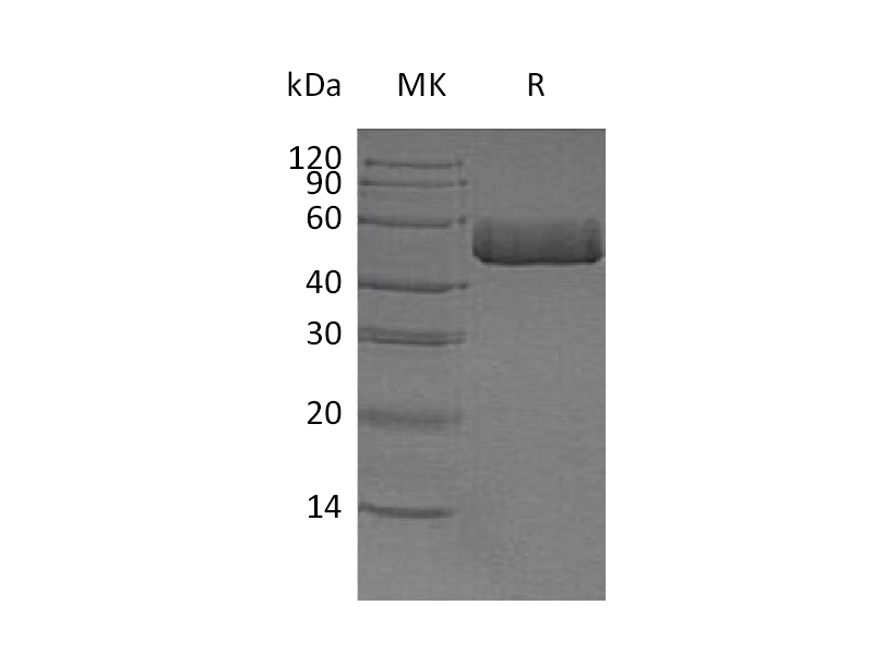 Recombinant Human ACPP (C-6His)