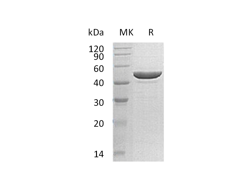Recombinant Human RRM2 (C-6His)