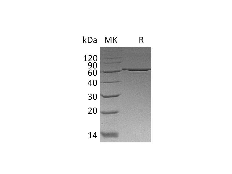 Recombinant Human P4HB (C-6His)