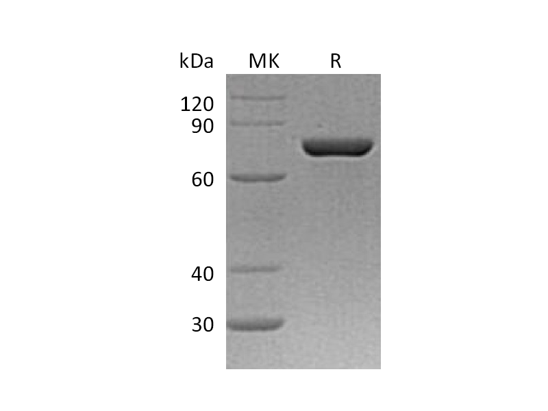 Recombinant Human PDIA4 (C-6His)