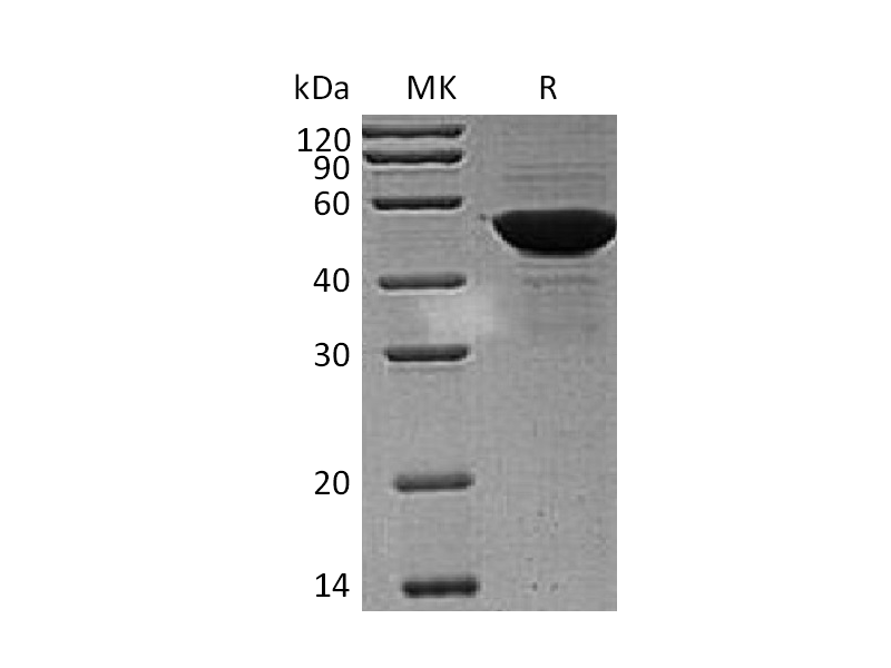 Recombinant Human PDIA6 (C-6His)