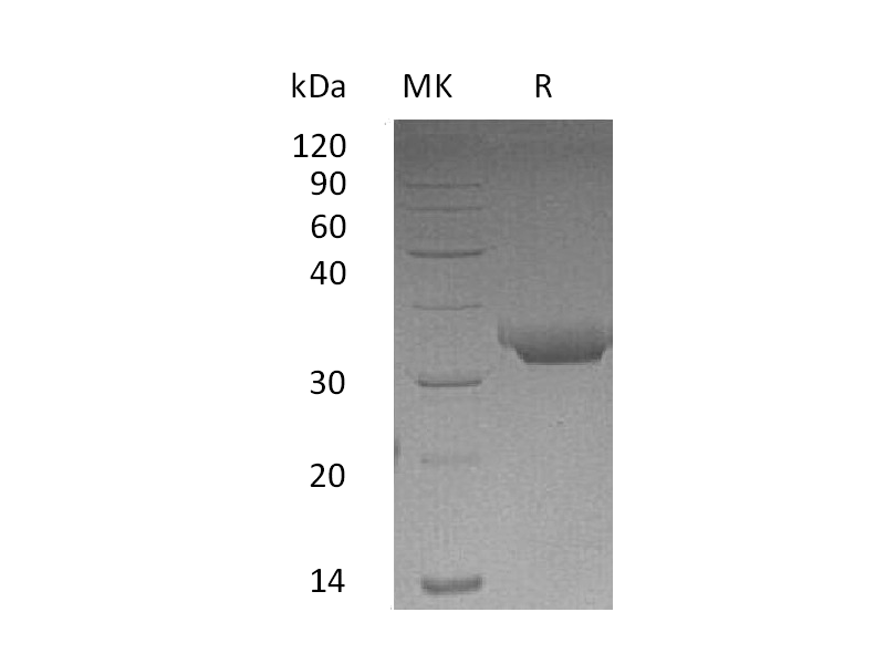 Recombinant Human PRTN3 (C-6His)