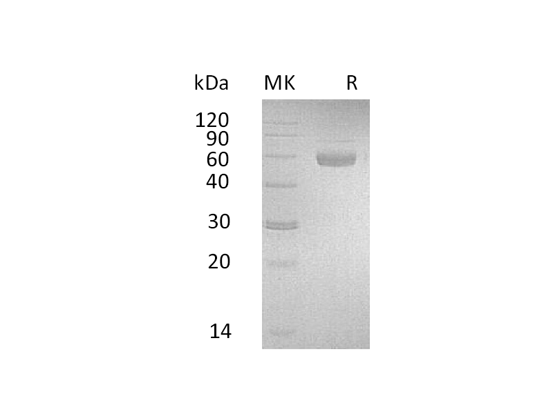 Recombinant Human PSG3 (C-6His)