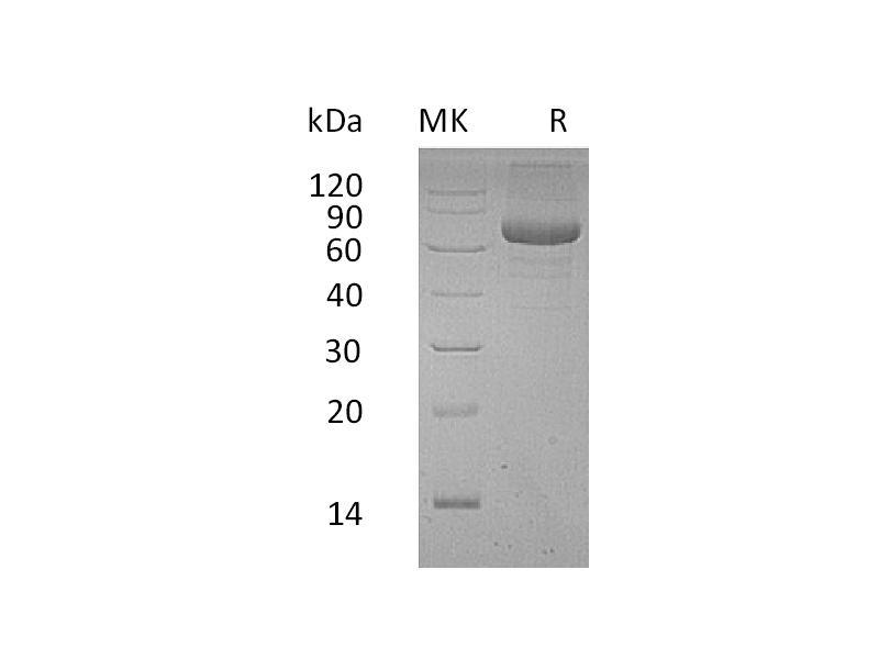 Recombinant Human PSG9 (C-6His)