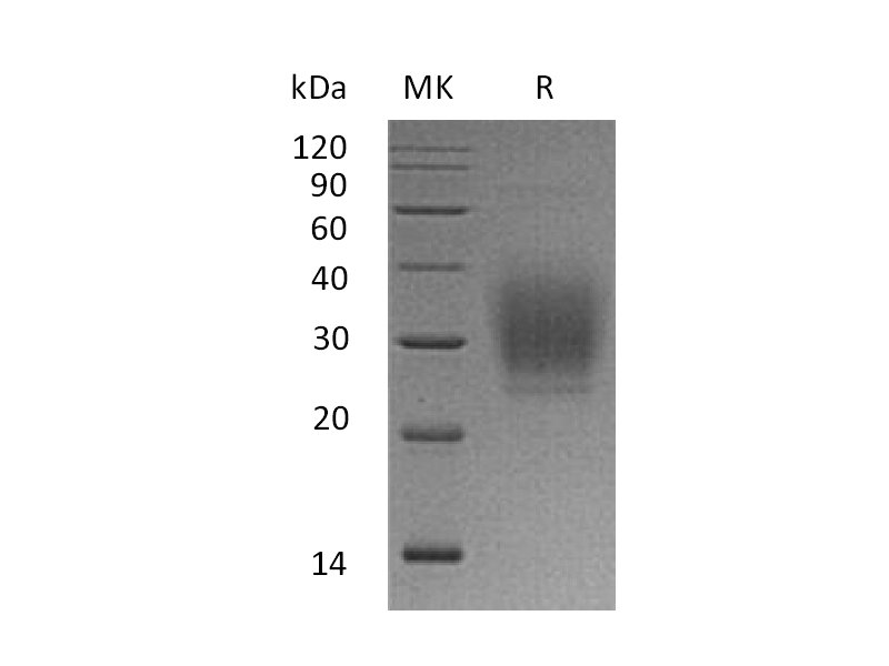 Recombinant Human PTH1R (C-6His)