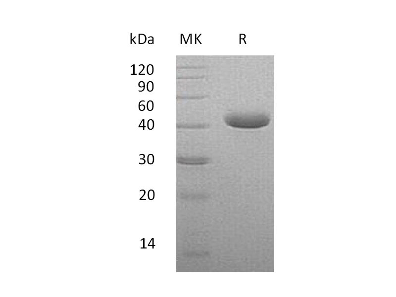 Recombinant Human Nectin-4 (C-6His)