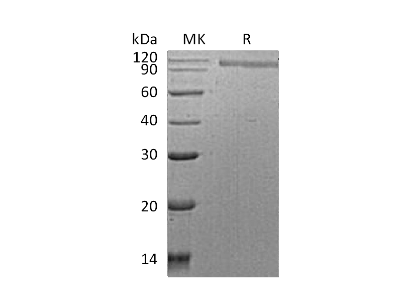 Recombinant Human HER2 (C-6His)