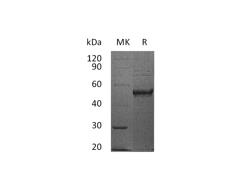 Recombinant Human HVEM (C-Fc)