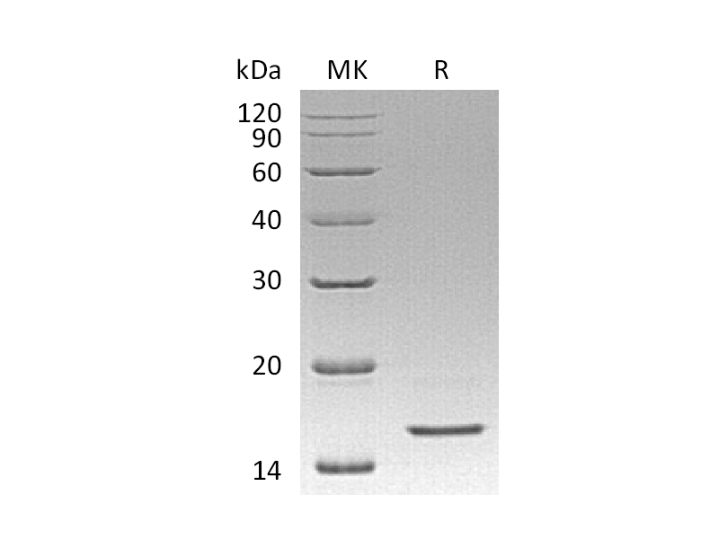 Recombinant Human REG4 (C-6His)