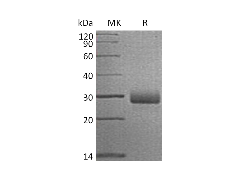 Recombinant Human RTBDN (C-6His)