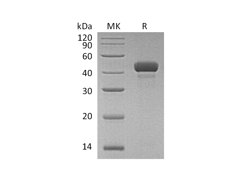 Recombinant Human RCN3 (C-6His)