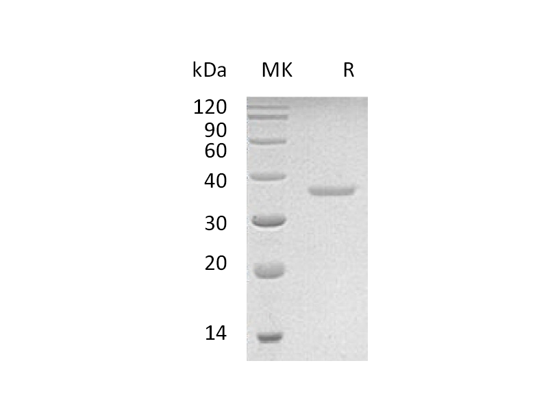 Recombinant Human PRPS2 (C-6His)