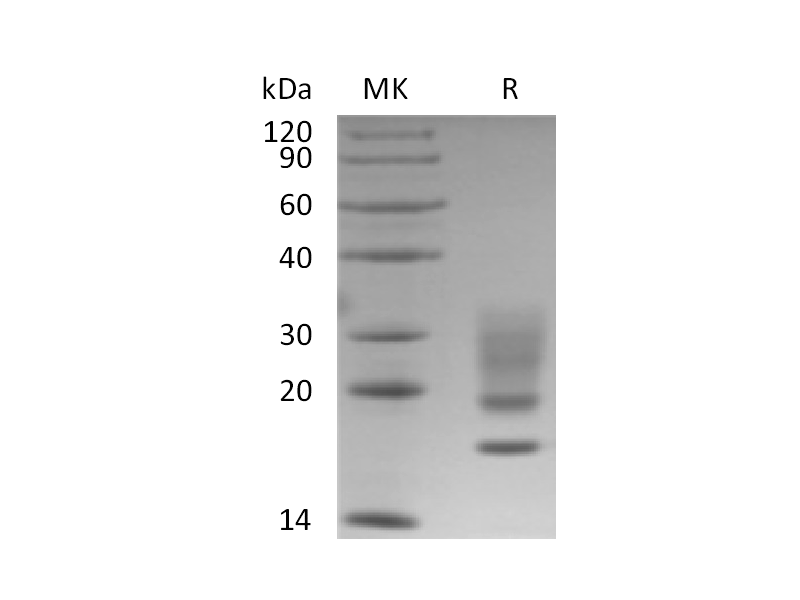 Recombinant Human RNASE 1 (C-6His)