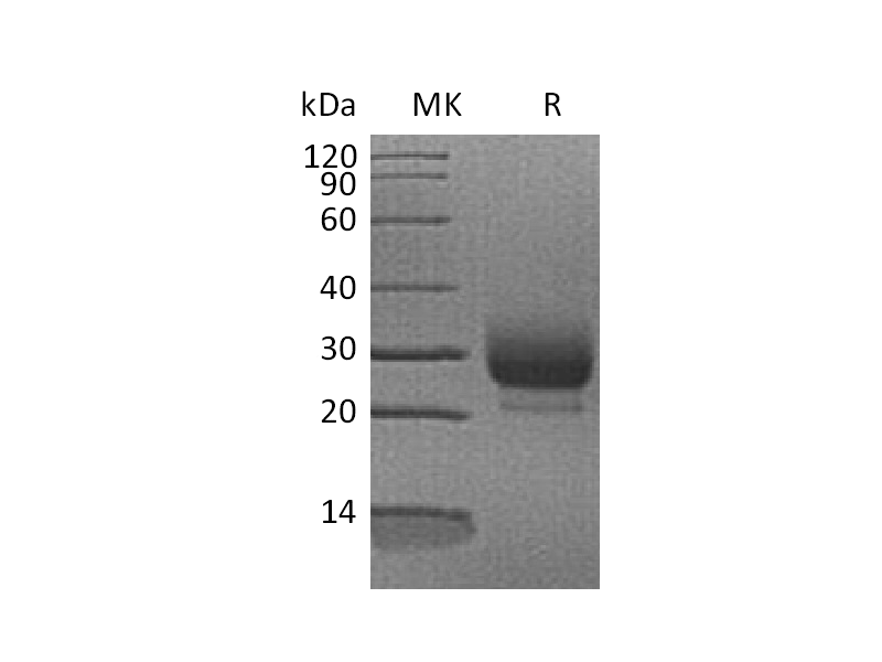 Recombinant Human RNASE3 (C-6His)