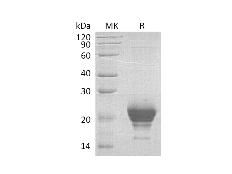 Recombinant Human RNASE 6 (C-6His)
