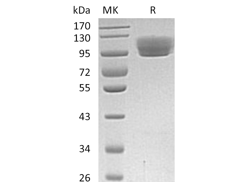 Recombinant Human ROBO4 (C-Fc)