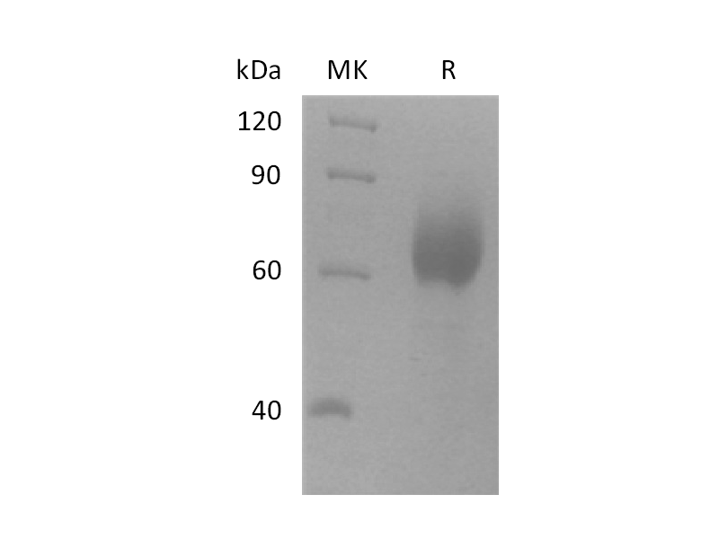 Recombinant Human SCARB2 (C-6His)