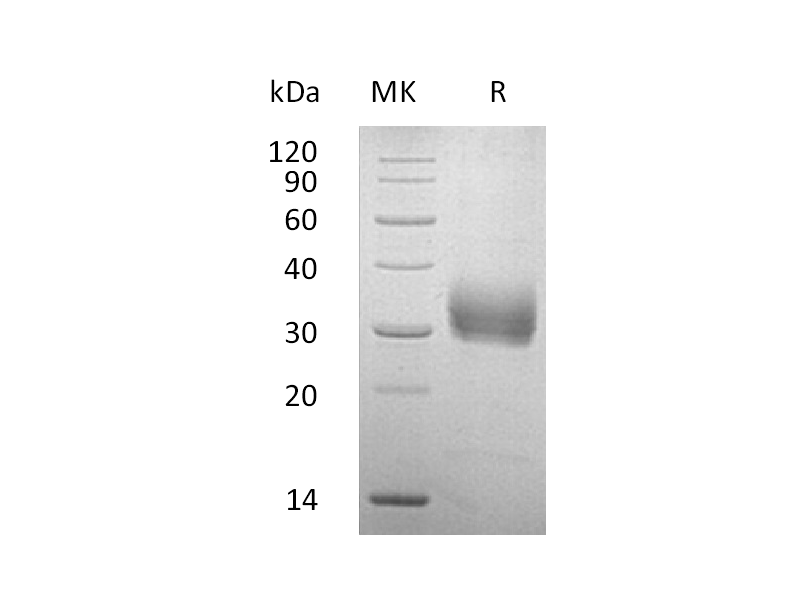 Recombinant Human SOST (C-6His)