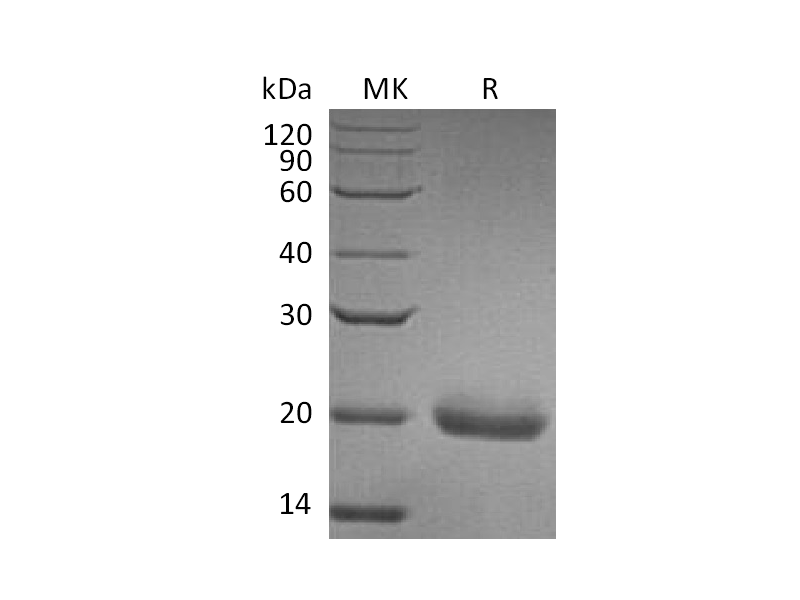 Recombinant Human SECTM1 (C-6His)
