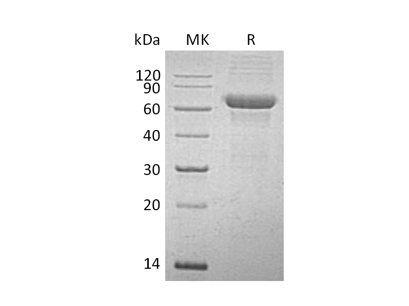 Recombinant Human SCG3 (C-6His)