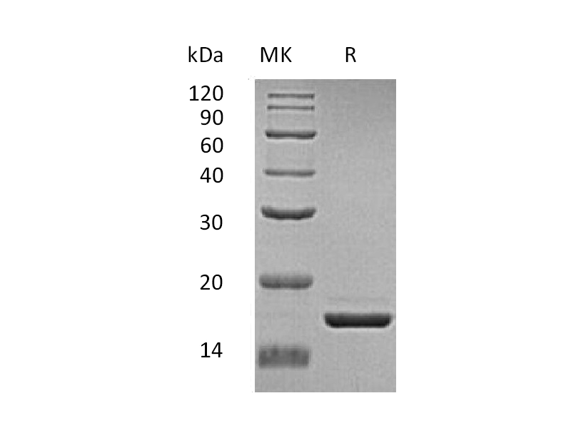 Recombinant Human ZG16 (C-6His)