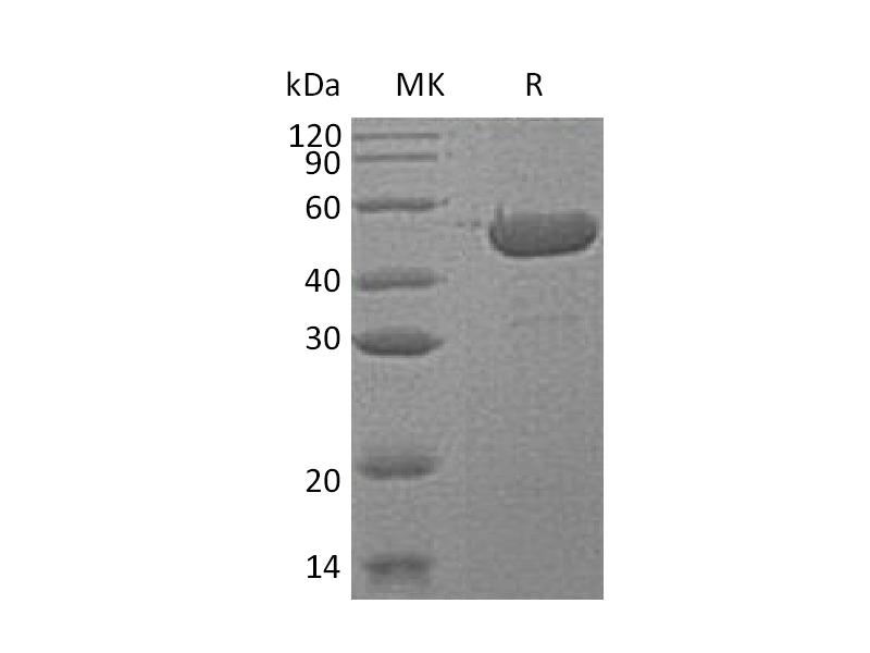 Recombinant Human SHPK (C-6His)