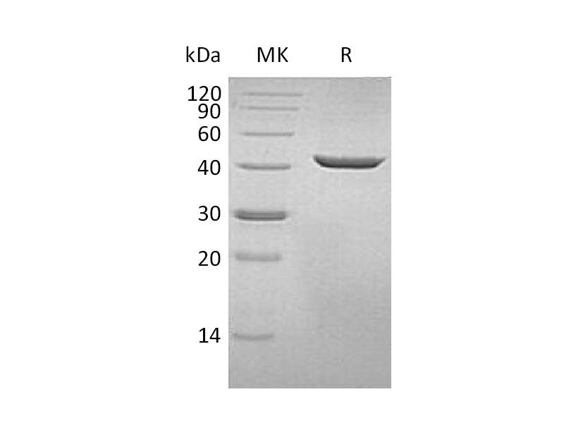 Recombinant Human SEPHS1 (C-6His)